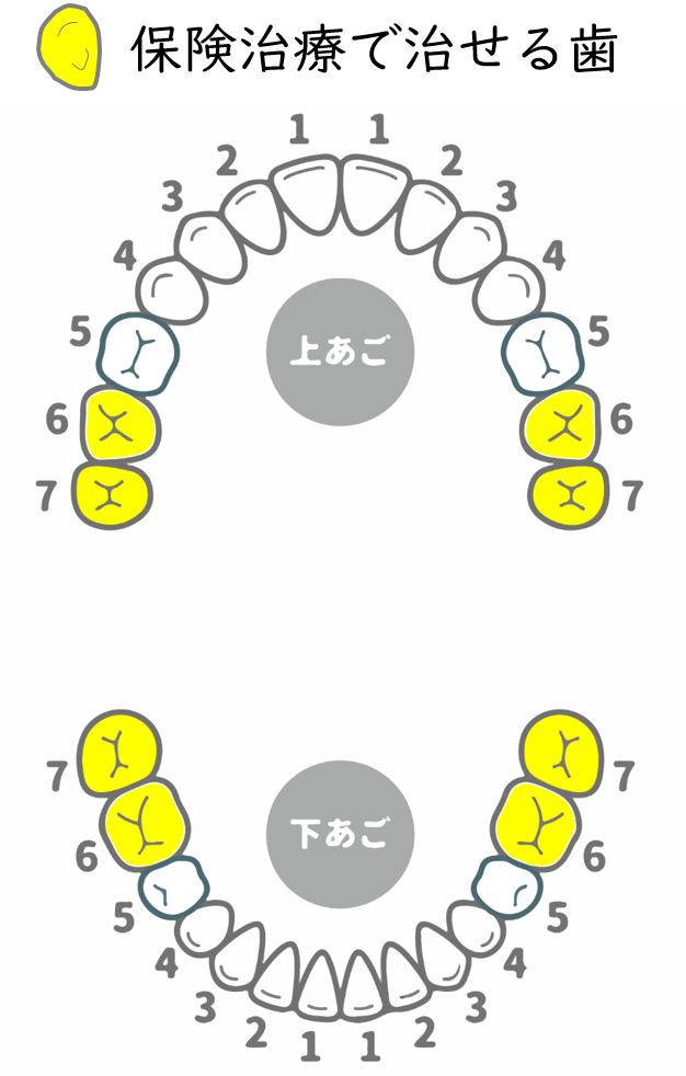 本所吾妻橋（浅草）徒歩3分の歯医者、鈴木歯科クリニックでPEEK冠